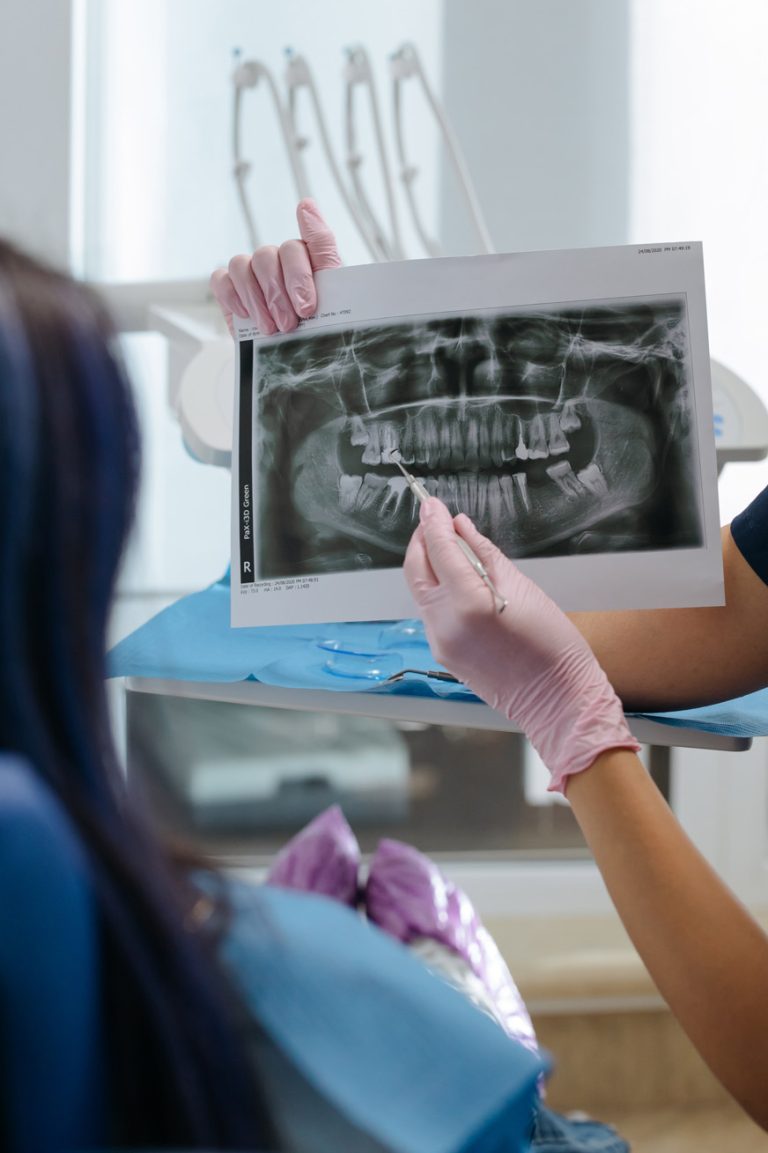 Picture of xray