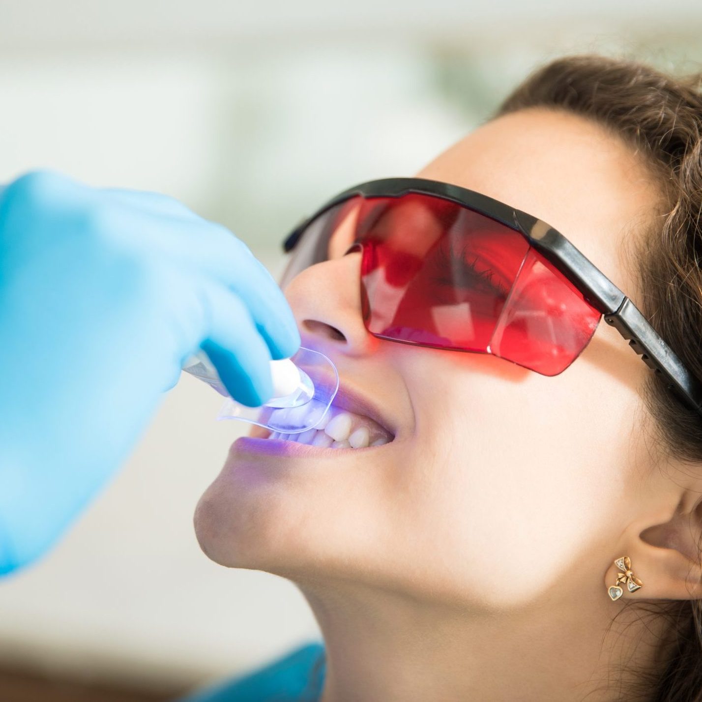 teeth whitening